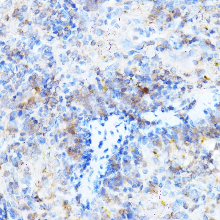 Immunohistochemistry - Anti-ULBP1 Antibody (A8629) - Antibodies.com