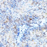 Immunohistochemistry - Anti-ULBP1 Antibody (A8629) - Antibodies.com