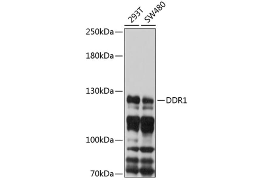 Western Blot - Anti-MCK10/NEP Antibody (A8630) - Antibodies.com