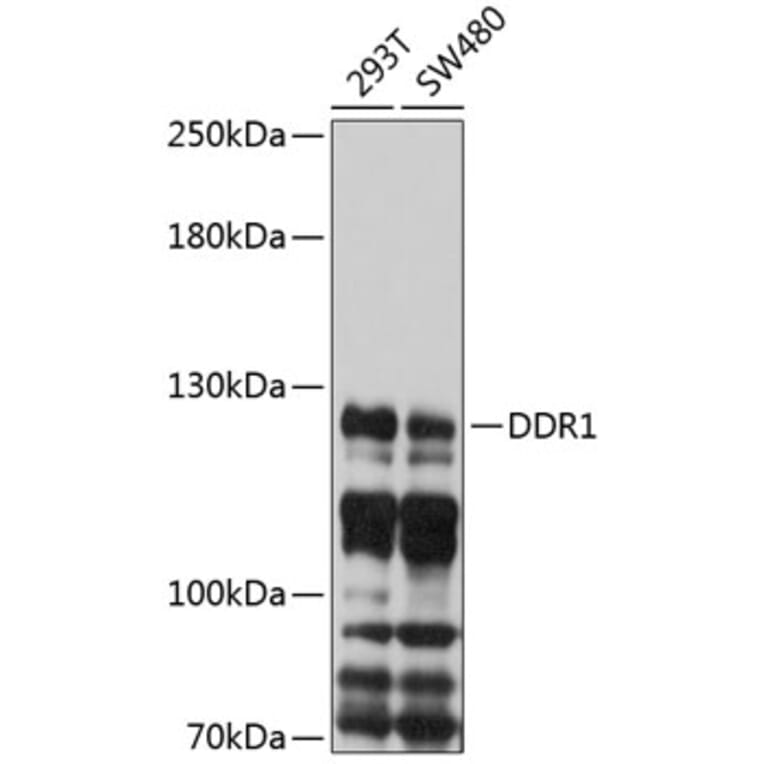 Western Blot - Anti-MCK10/NEP Antibody (A8630) - Antibodies.com