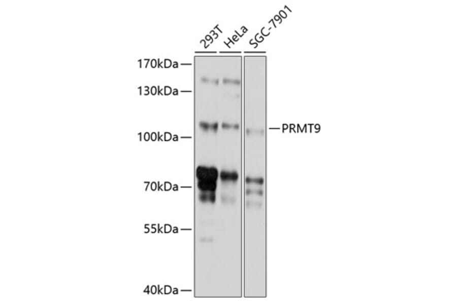 Western Blot - Anti-PRMT10 Antibody (A8632) - Antibodies.com