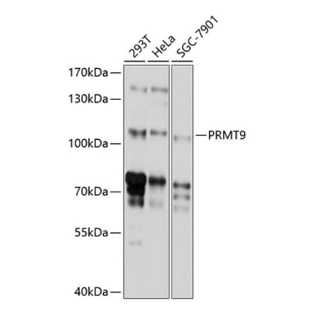 Western Blot - Anti-PRMT10 Antibody (A8632) - Antibodies.com