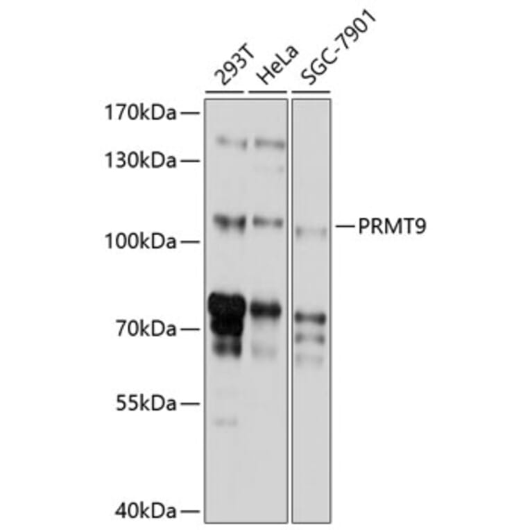 Western Blot - Anti-PRMT10 Antibody (A8632) - Antibodies.com