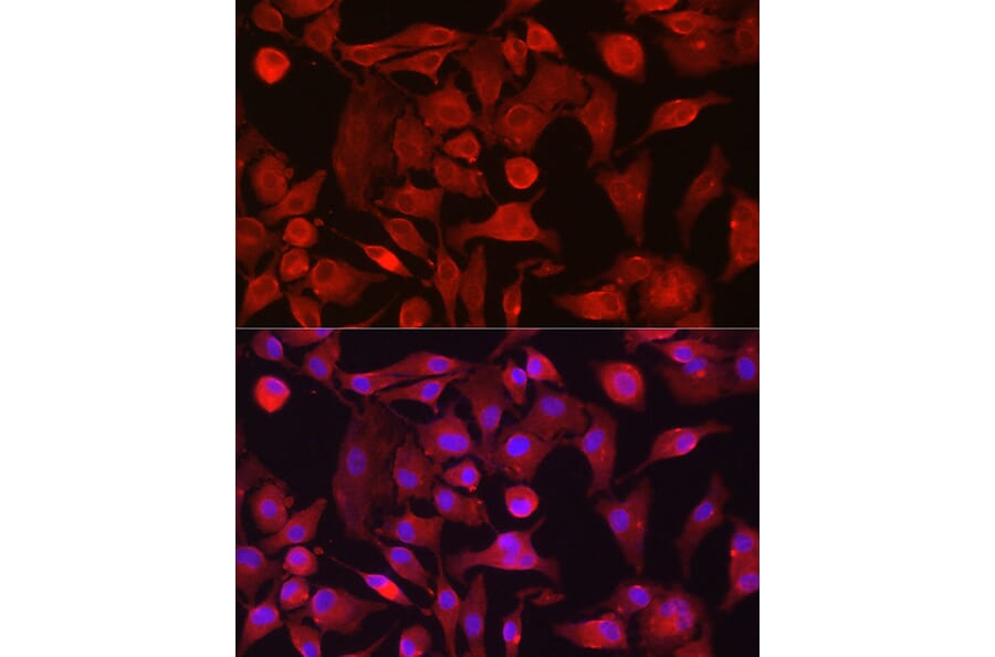 Immunofluorescence - Anti-RASGRP1 Antibody (A8633) - Antibodies.com