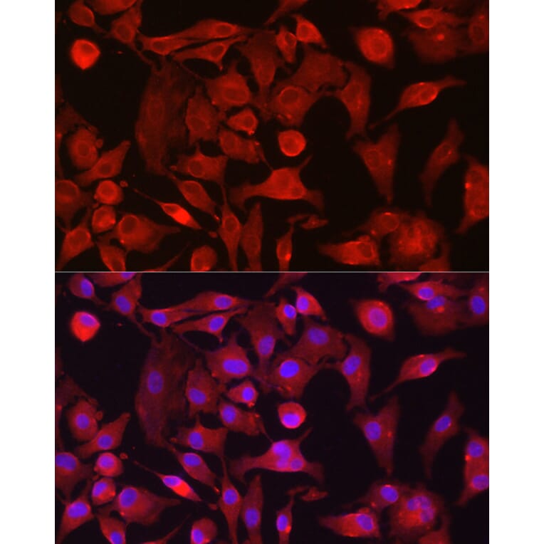 Immunofluorescence - Anti-RASGRP1 Antibody (A8633) - Antibodies.com