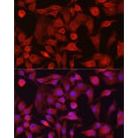Immunofluorescence - Anti-RASGRP1 Antibody (A8633) - Antibodies.com