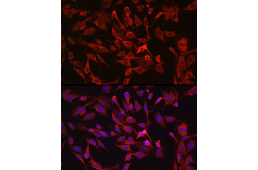 Immunofluorescence - Anti-RASGRP1 Antibody (A8633) - Antibodies.com