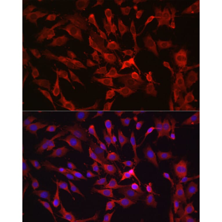 Immunofluorescence - Anti-RASGRP1 Antibody (A8633) - Antibodies.com