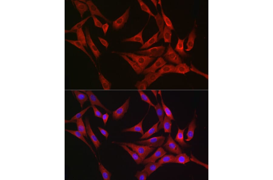Immunofluorescence - Anti-RASGRP1 Antibody (A8633) - Antibodies.com