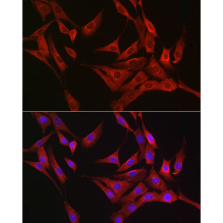 Immunofluorescence - Anti-RASGRP1 Antibody (A8633) - Antibodies.com