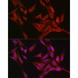 Immunofluorescence - Anti-RASGRP1 Antibody (A8633) - Antibodies.com