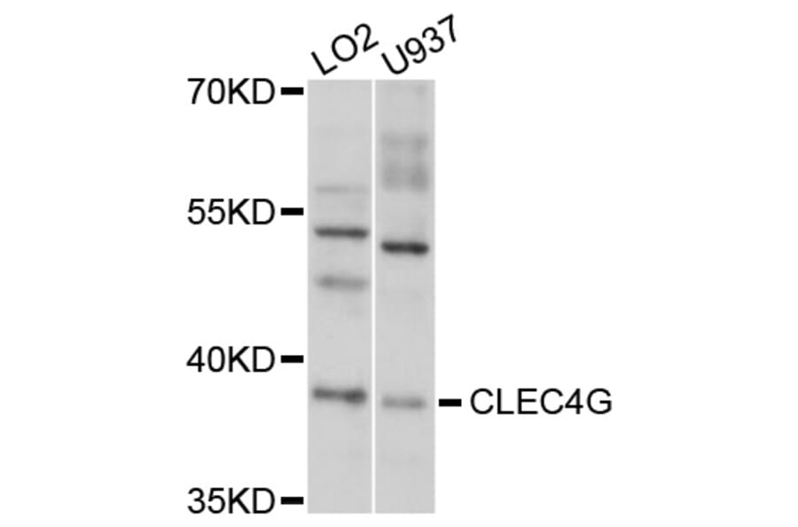 Western Blot - Anti-CLEC4G Antibody (A10500) - Antibodies.com