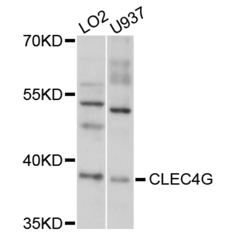 Western Blot - Anti-CLEC4G Antibody (A10500) - Antibodies.com
