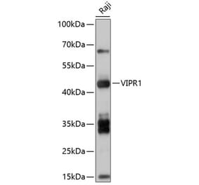 Western Blot - Anti-VPAC1 Antibody (A8638) - Antibodies.com