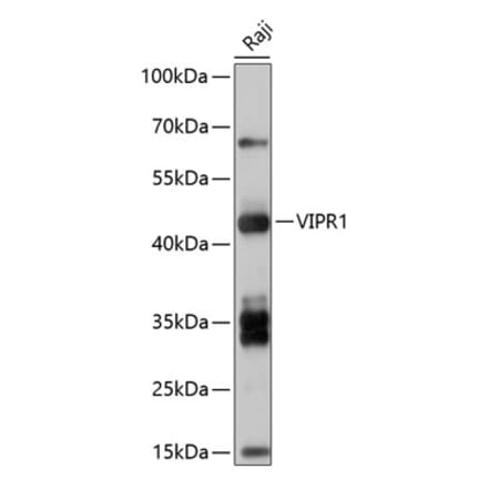 Western Blot - Anti-VPAC1 Antibody (A8638) - Antibodies.com