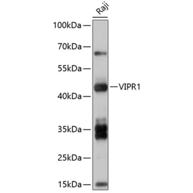 Western Blot - Anti-VPAC1 Antibody (A8638) - Antibodies.com