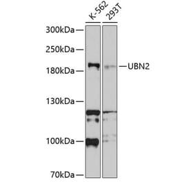Western Blot - Anti-UBN2 Antibody (A8639) - Antibodies.com