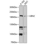 Western Blot - Anti-UBN2 Antibody (A8639) - Antibodies.com