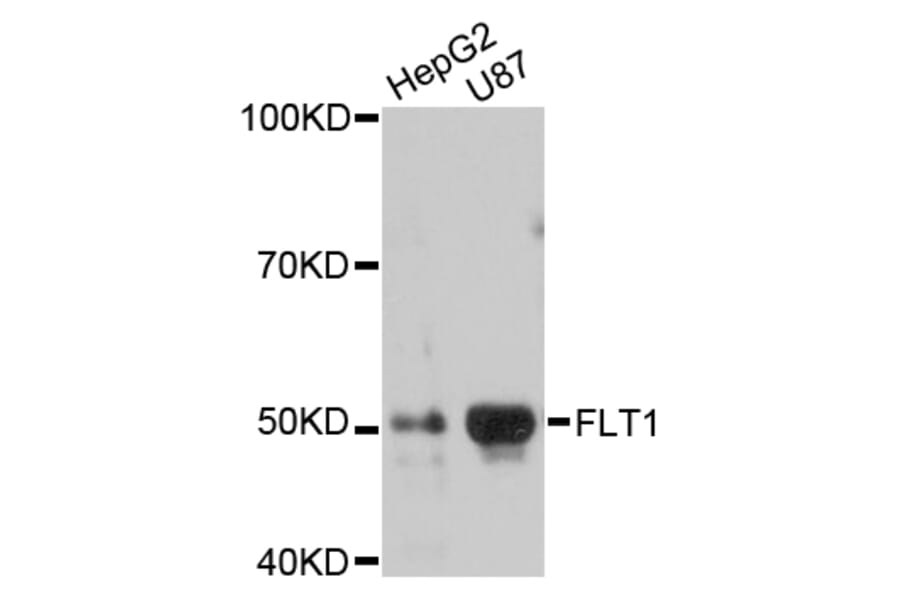 Western Blot - Anti-FLT1 Antibody (A10524) - Antibodies.com