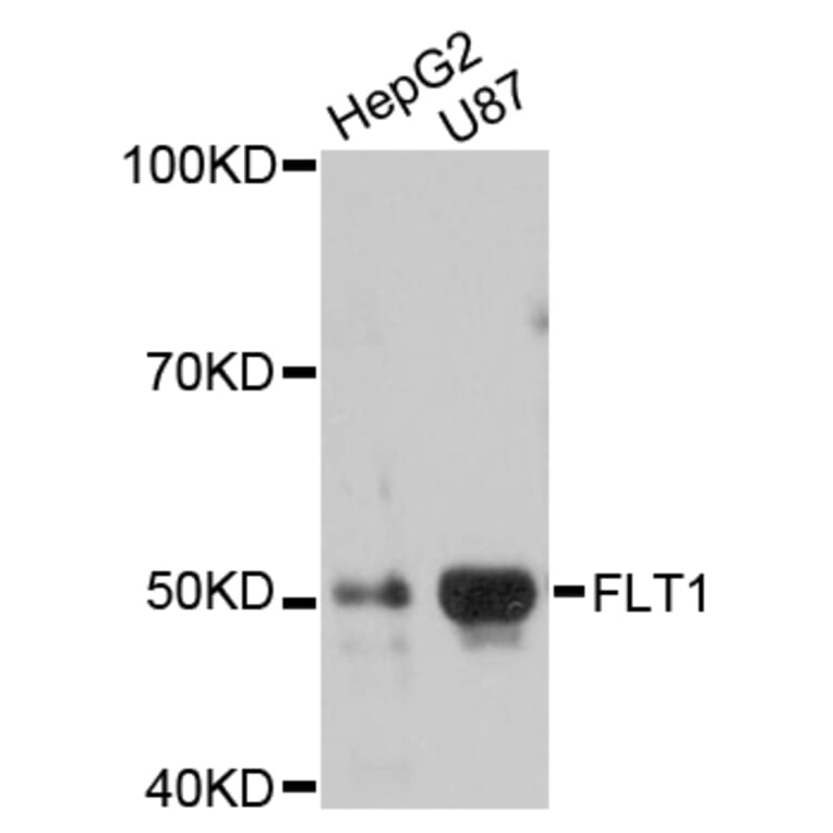 Western Blot - Anti-FLT1 Antibody (A10524) - Antibodies.com