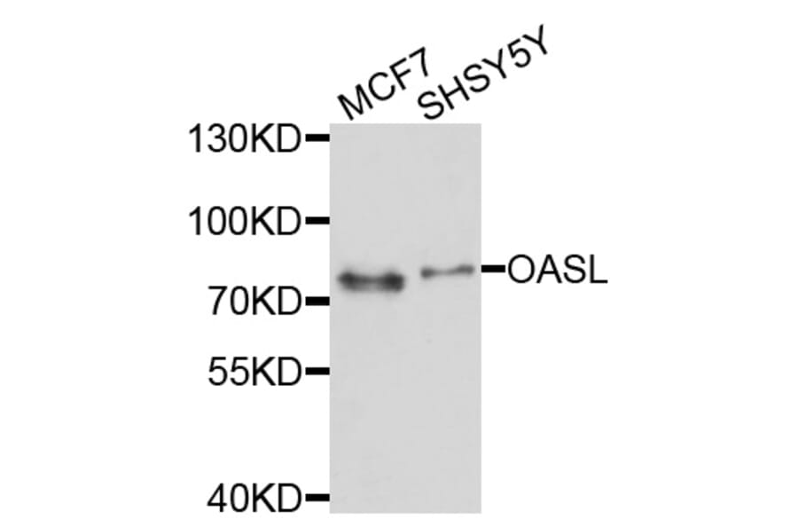 Western Blot - Anti-OASL Antibody (A10527) - Antibodies.com