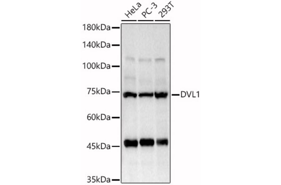 Western Blot - Anti-Dishevelled/Dvl1 Antibody (A8643) - Antibodies.com