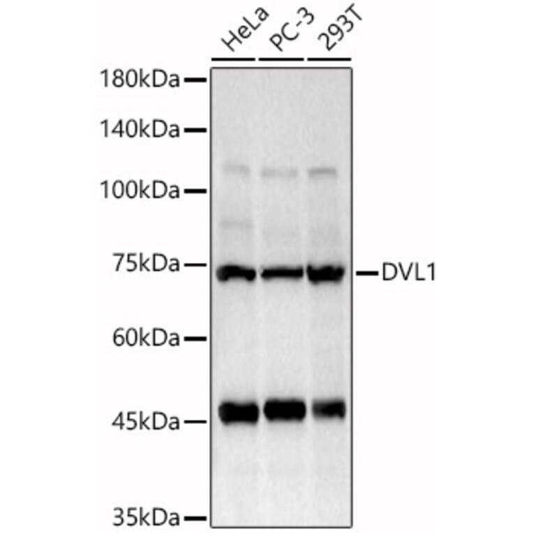 Western Blot - Anti-Dishevelled/Dvl1 Antibody (A8643) - Antibodies.com