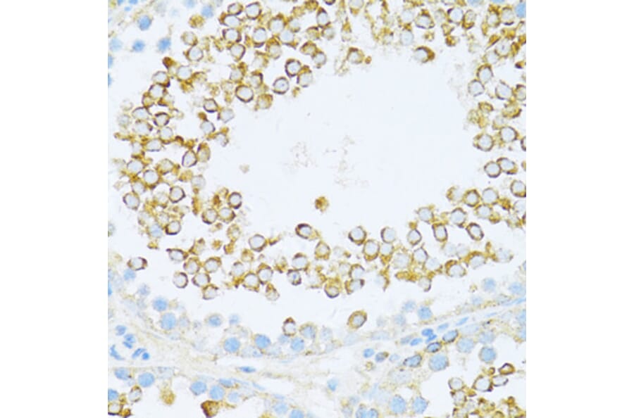 Immunohistochemistry - Anti-Dishevelled/Dvl1 Antibody (A8643) - Antibodies.com