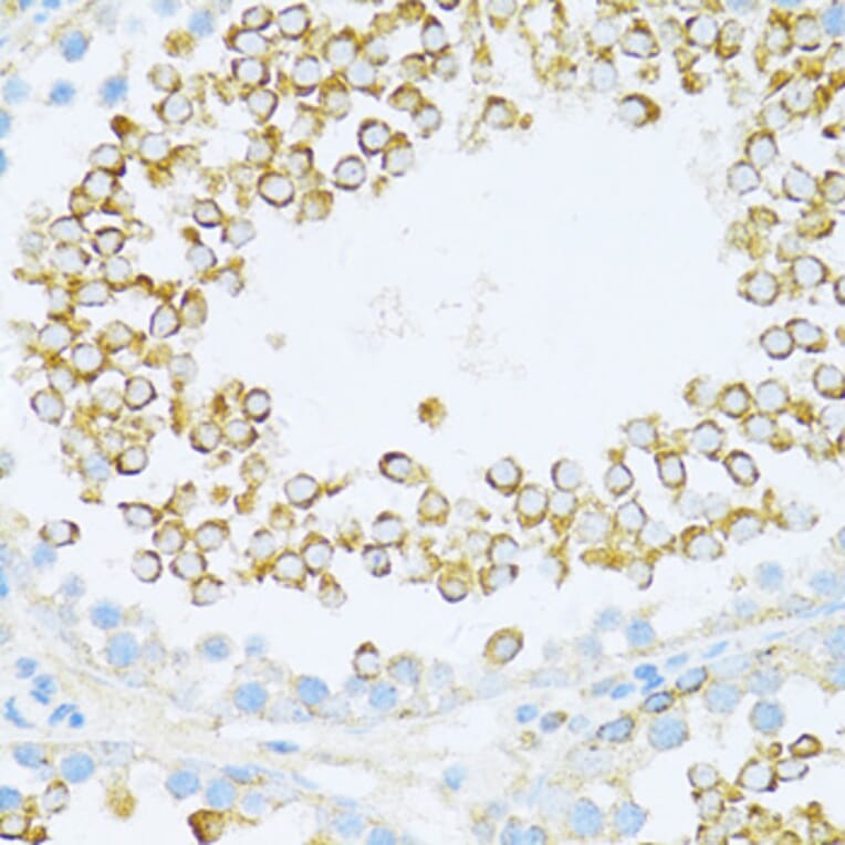 Immunohistochemistry - Anti-Dishevelled/Dvl1 Antibody (A8643) - Antibodies.com
