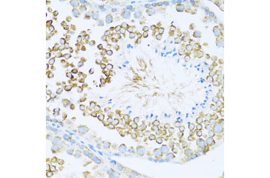 Immunohistochemistry - Anti-Dishevelled/Dvl1 Antibody (A8643) - Antibodies.com