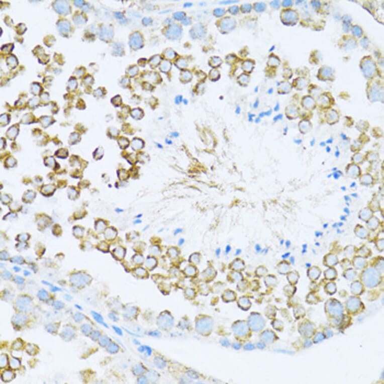 Immunohistochemistry - Anti-Dishevelled/Dvl1 Antibody (A8643) - Antibodies.com