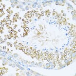 Immunohistochemistry - Anti-Dishevelled/Dvl1 Antibody (A8643) - Antibodies.com