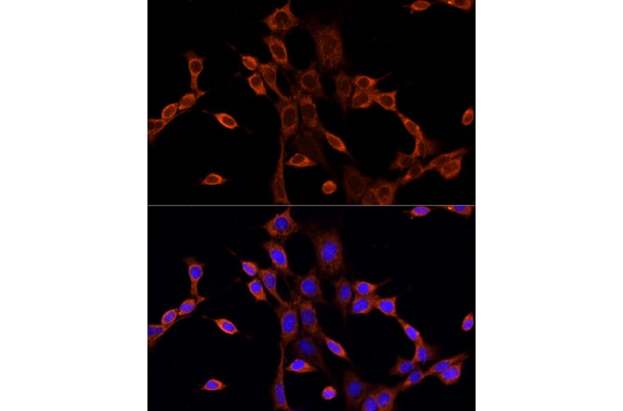 Immunofluorescence - Anti-Dishevelled/Dvl1 Antibody (A8643) - Antibodies.com