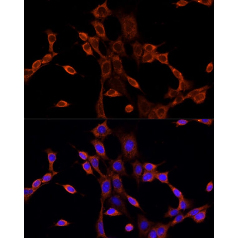 Immunofluorescence - Anti-Dishevelled/Dvl1 Antibody (A8643) - Antibodies.com