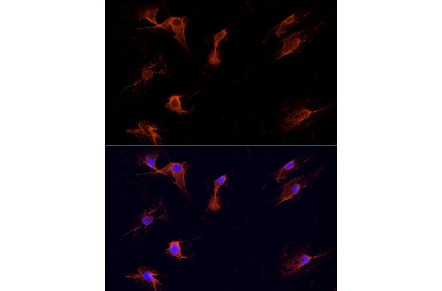 Immunofluorescence - Anti-Dishevelled/Dvl1 Antibody (A8643) - Antibodies.com