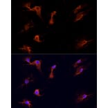 Immunofluorescence - Anti-Dishevelled/Dvl1 Antibody (A8643) - Antibodies.com