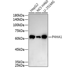 Western Blot - Anti-P4HA1 Antibody (A8644) - Antibodies.com