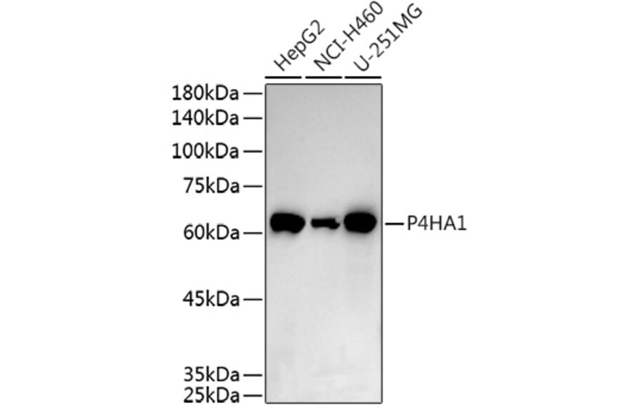 Western Blot - Anti-P4HA1 Antibody (A8644) - Antibodies.com
