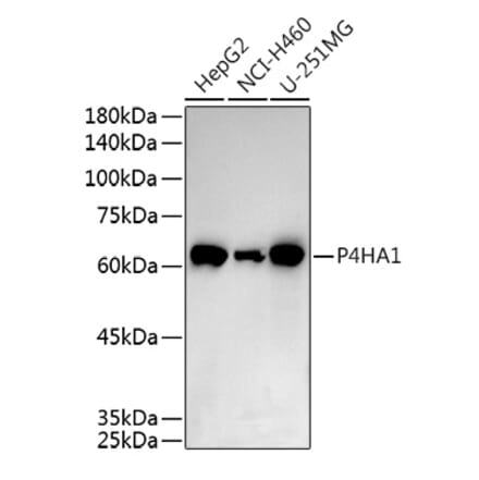Western Blot - Anti-P4HA1 Antibody (A8644) - Antibodies.com