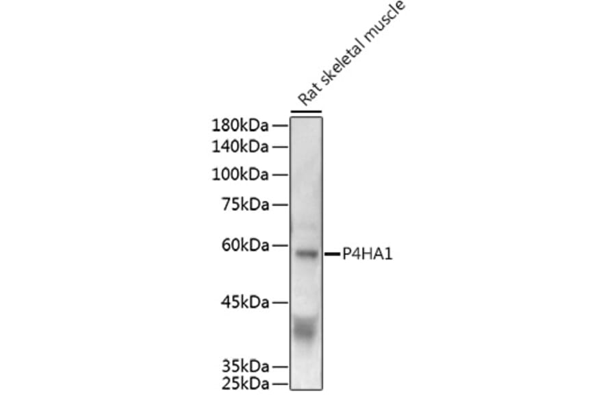 Western Blot - Anti-P4HA1 Antibody (A8644) - Antibodies.com