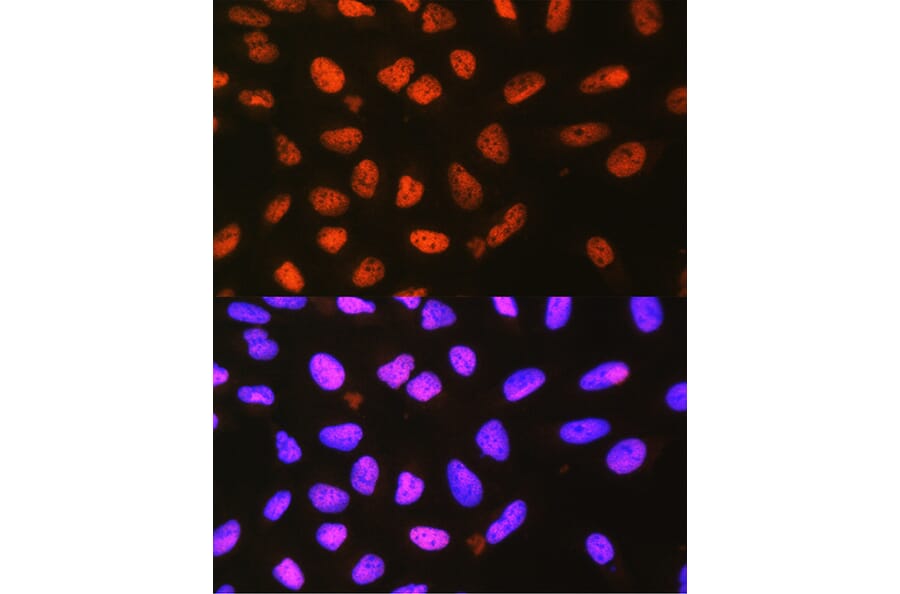 Immunofluorescence - Anti-P4HA1 Antibody (A8644) - Antibodies.com