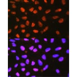 Immunofluorescence - Anti-P4HA1 Antibody (A8644) - Antibodies.com