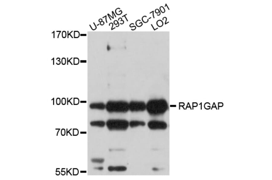 Western Blot - Anti-RAP1GAP Antibody (A10539) - Antibodies.com