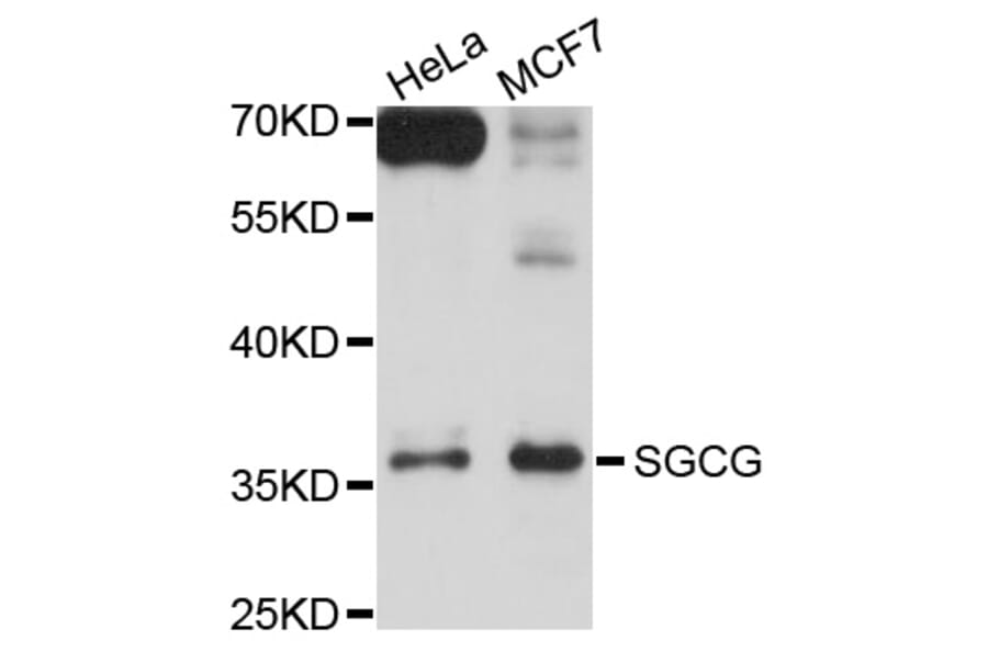 Western Blot - Anti-SGCG Antibody (A10540) - Antibodies.com