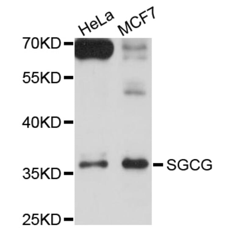 Western Blot - Anti-SGCG Antibody (A10540) - Antibodies.com