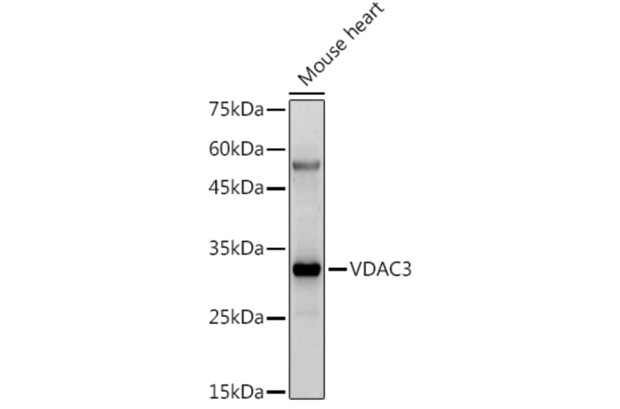 Western Blot - Anti-VDAC3 Antibody (A8647) - Antibodies.com