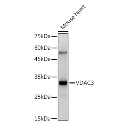 Western Blot - Anti-VDAC3 Antibody (A8647) - Antibodies.com