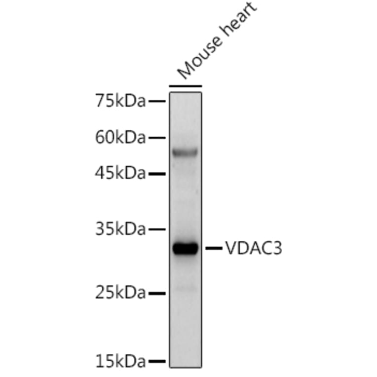 Western Blot - Anti-VDAC3 Antibody (A8647) - Antibodies.com