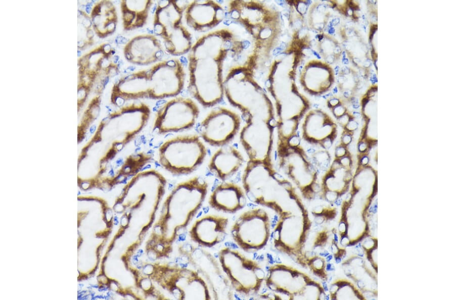 Immunohistochemistry - Anti-VDAC3 Antibody (A8647) - Antibodies.com