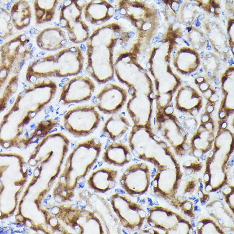 Immunohistochemistry - Anti-VDAC3 Antibody (A8647) - Antibodies.com